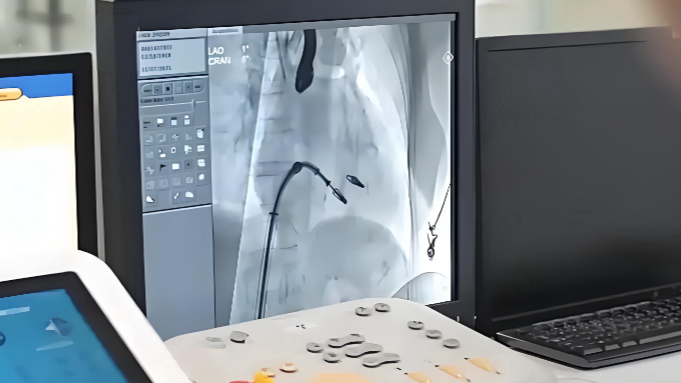 远程手术离“实用”还有多远