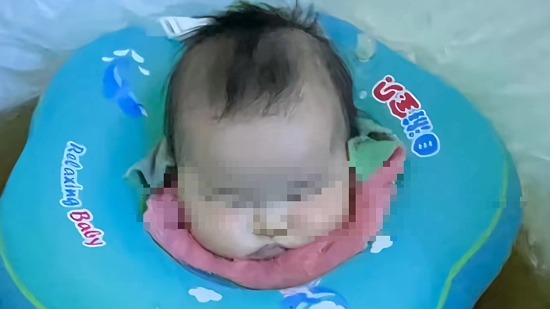 4个多月女婴在母婴店泡药浴后离世