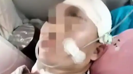 23岁研究生遭遇车祸 心智如幼童