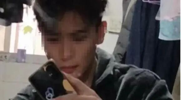 男生因室友电瓶燃爆全身90%烧伤