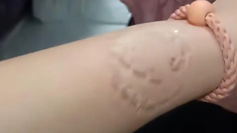 女子卧铺被大妈占 争吵中被咬起疱疹
